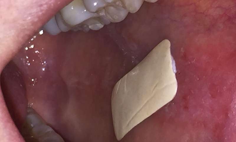 Plaster which sticks inside the mouth will revolutionise treatment of oral conditions
