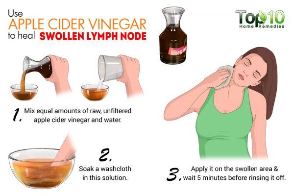 apple cider vinegar for swollen lymph nodes